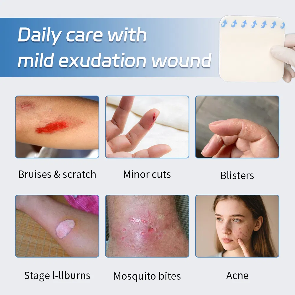 Hydrocolloid Dressing 6