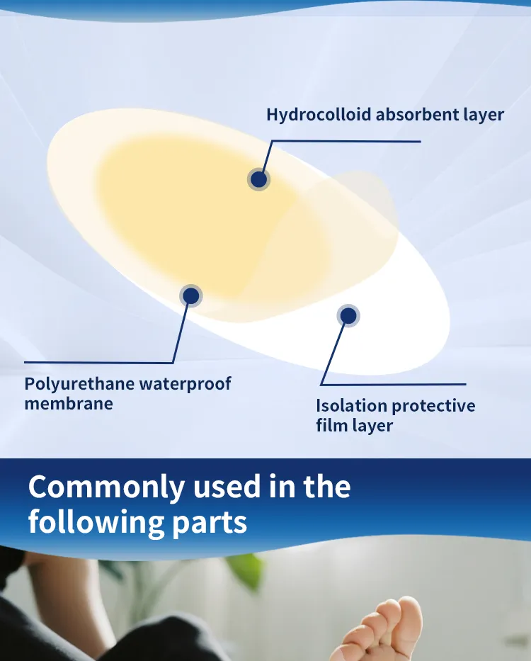 Hydrocolloid Roll 3