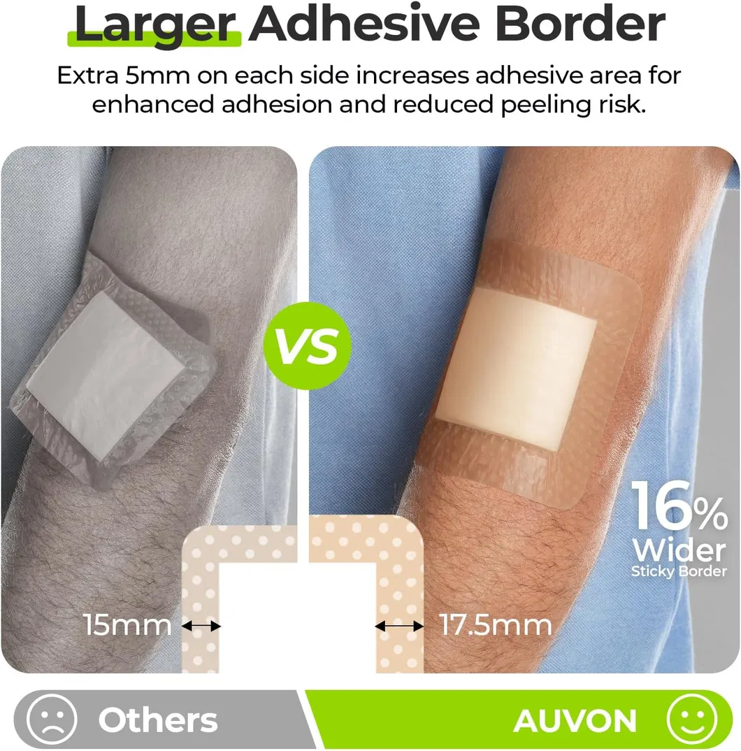 Features 2