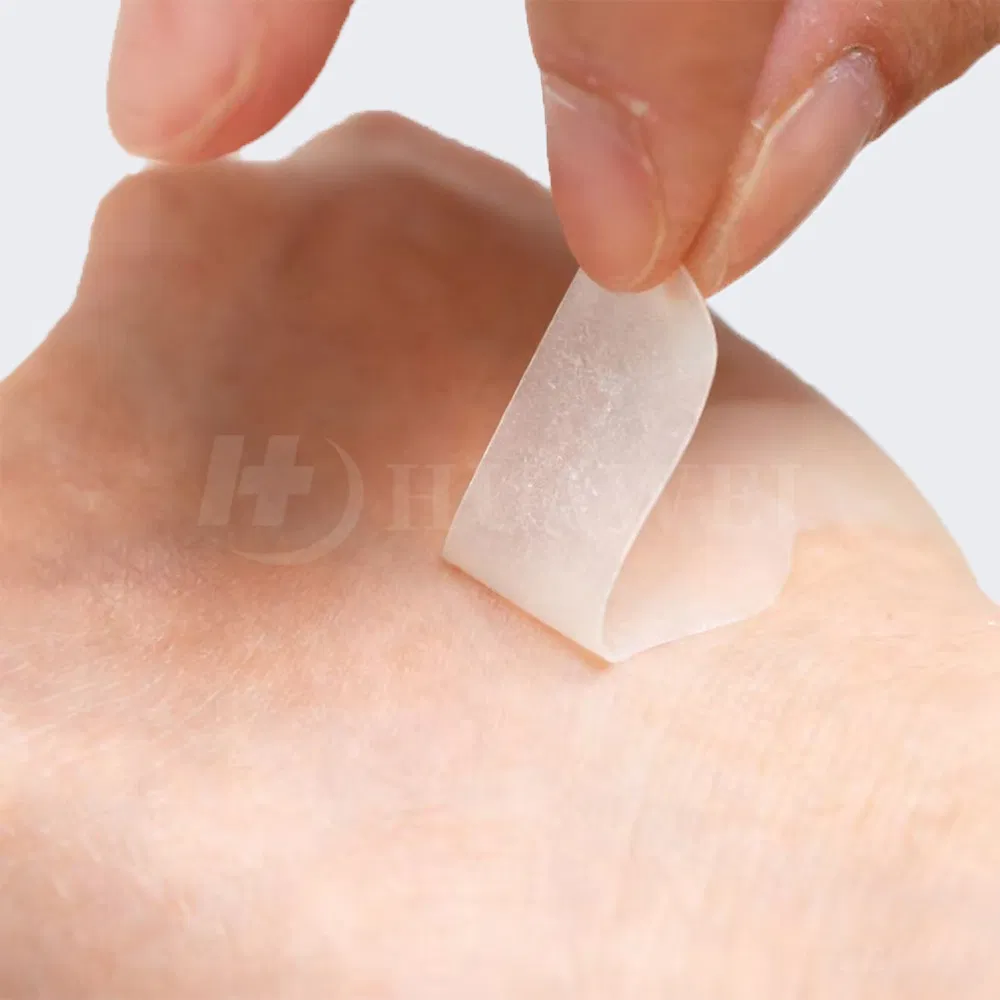 لفافة ضمادة هيدروكولودية للجروح المزمنة، 5cm × 5m, تدير الإفرازات والرائحة، متاحة حسب الطلب