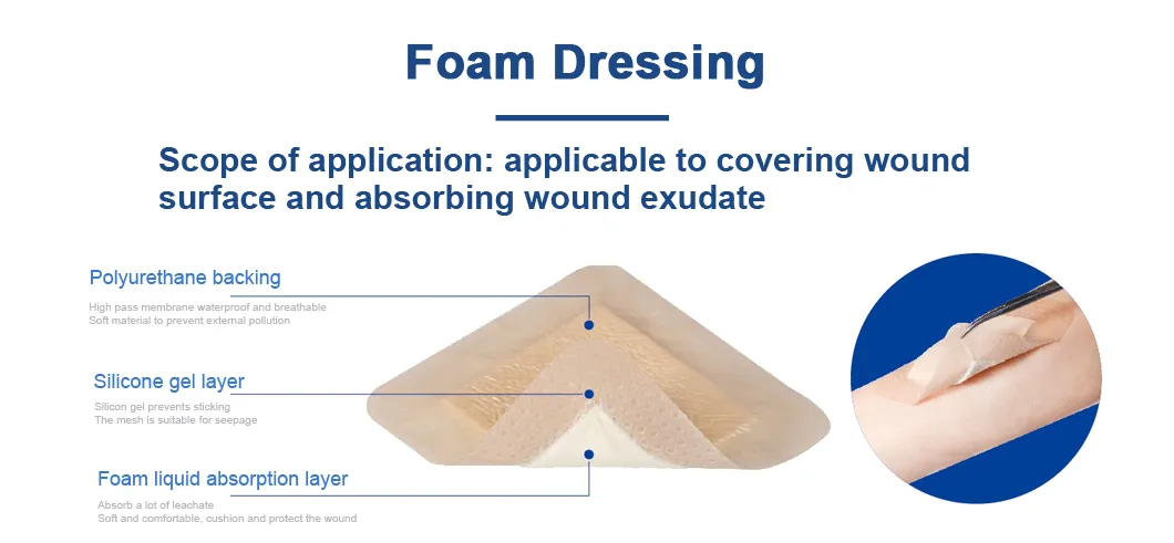 Foam Dressing Application