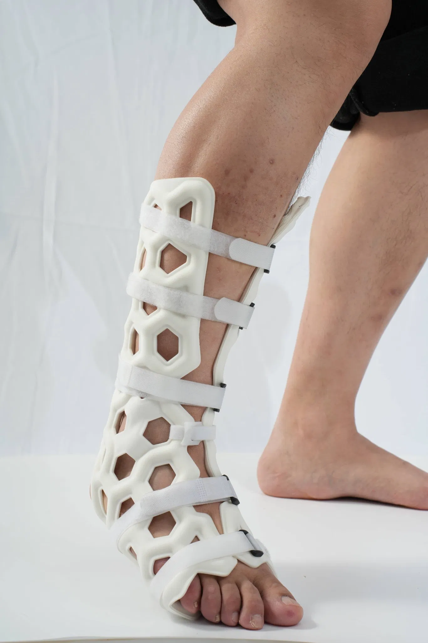 Waterproof and Breathable Orthopedic Products External Fixation Braces for Foot