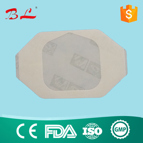 Medical Supply Factory Price Sterile Catheter Fixation Dressing for IV -F