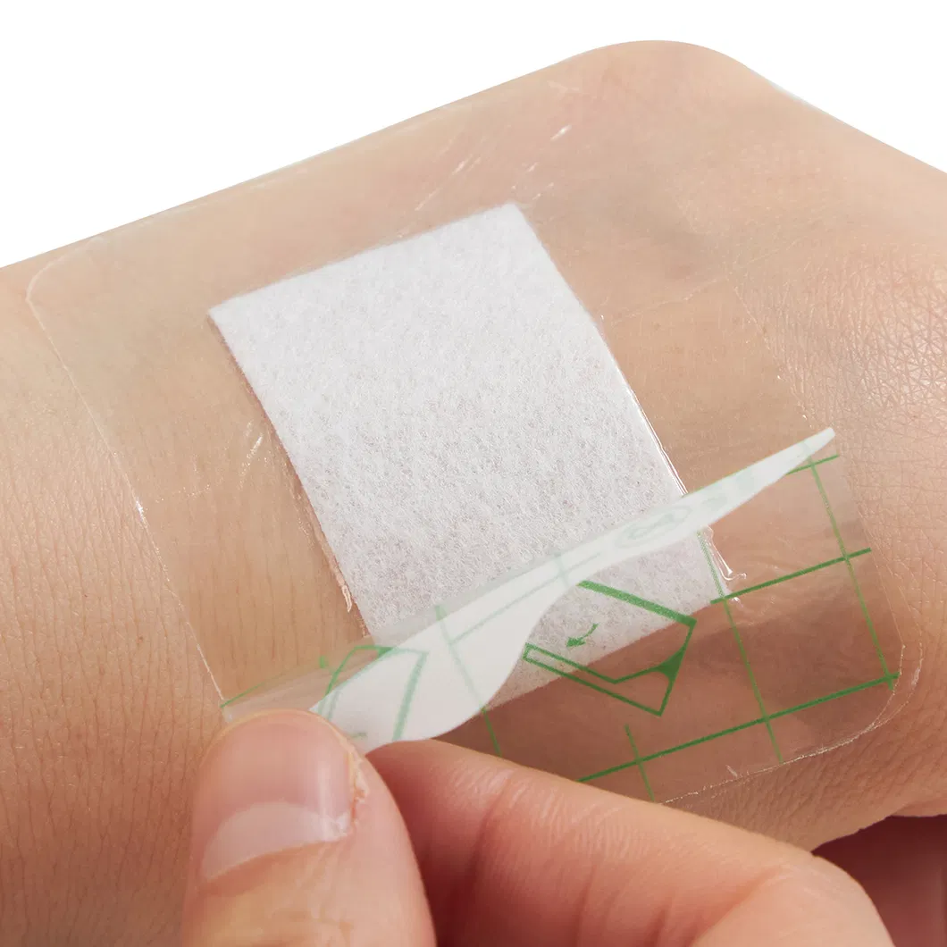 Wound Dressing Photo 4