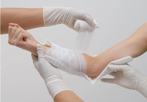 Orthopedic Casting Tape Knee Braces Fractured Bone External Fixation Hot Sale