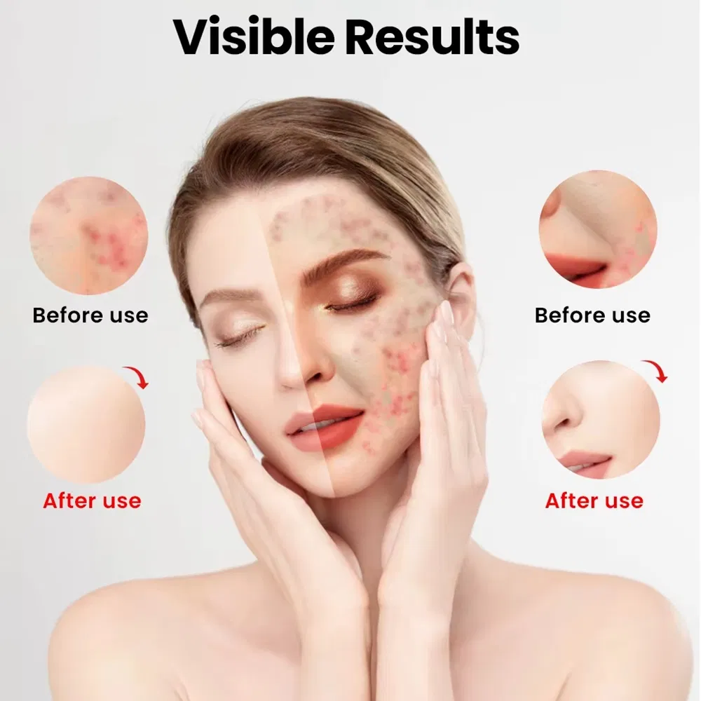 510K Medical Grade Near Infrared Silicone Face Neck Mask LED Facial Mask for Home Skin Beauty, ODM OEM Blue Red Light Therapy Mask Wholesale