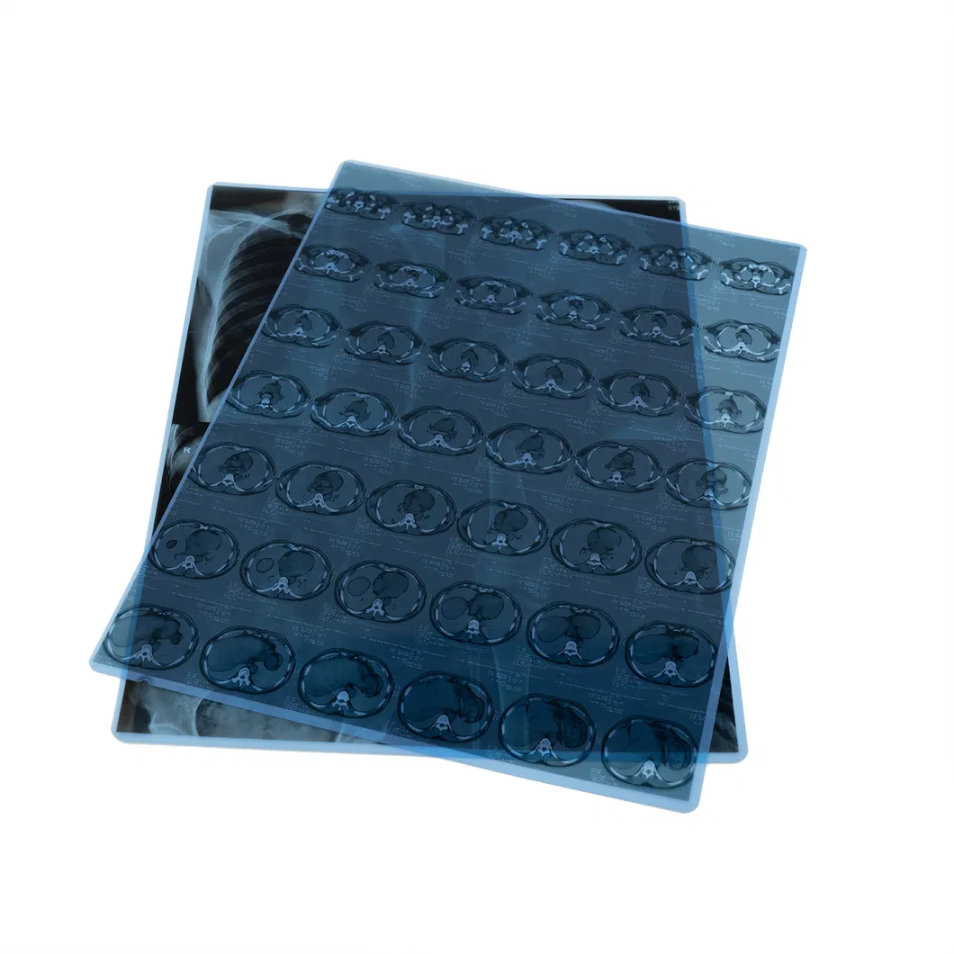 X-ray Film Solution 2