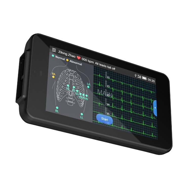 Wholesale High Quality CE Medical Testing ECG Signal Monitoring Patient Monitor Portable Household 12 Channel ECG Equipment Pocket ECG Machine