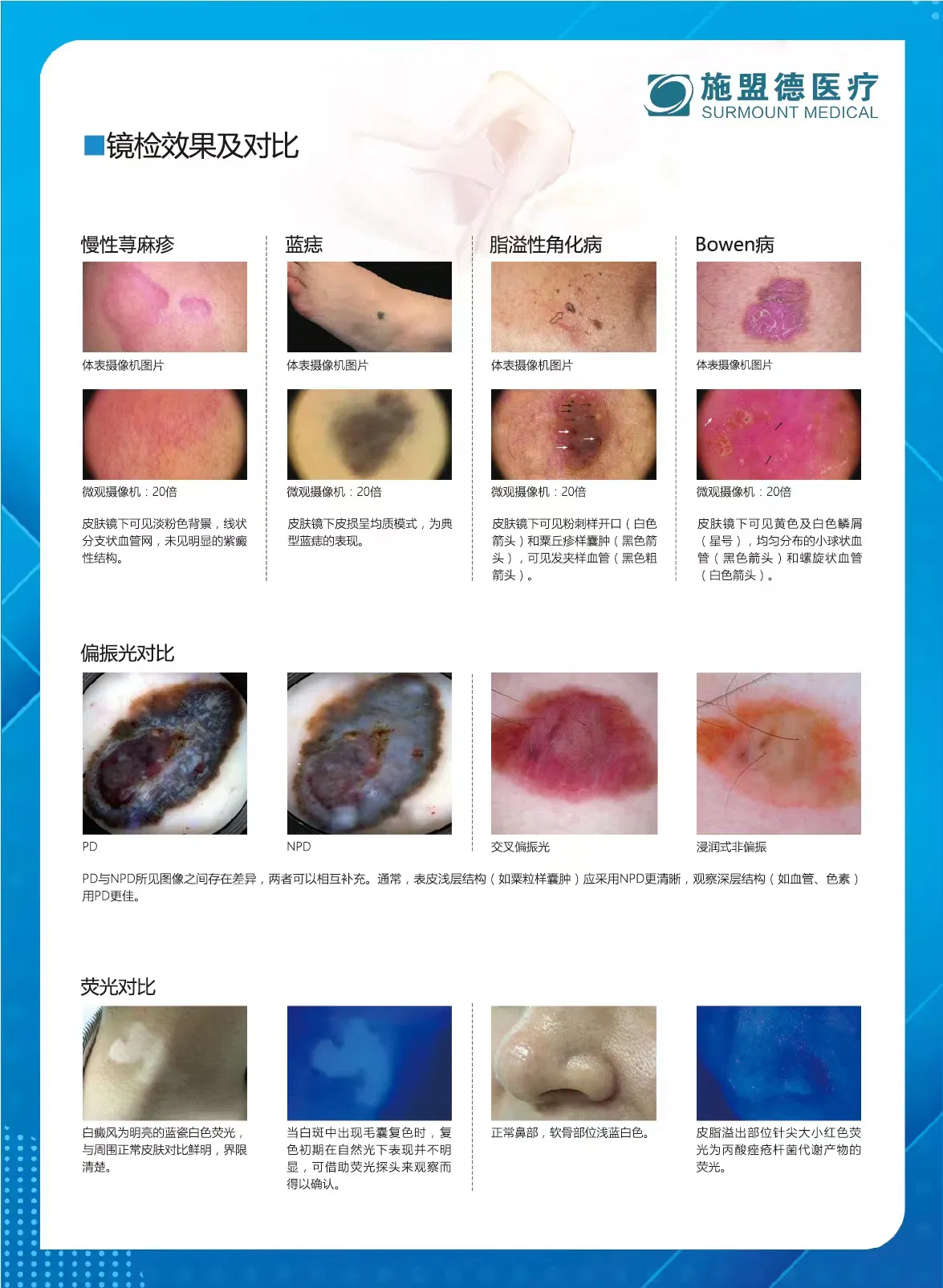 Smart Dermatoscope with Mobile Connectivity and Analysis Tools