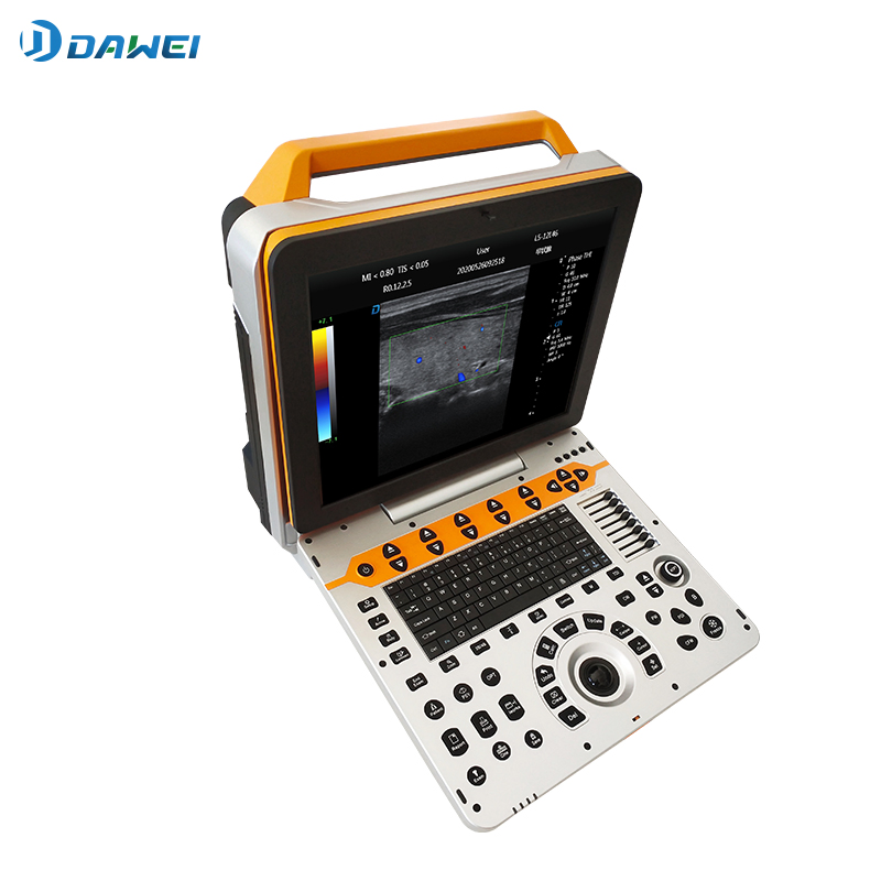 Dawei Dw-P60 High Quality 4D Color Doppler Ultrasound Diagnostic Scanner