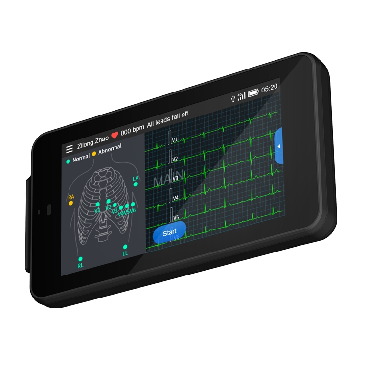 Wholesale High Quality CE Medical Testing ECG Signal Monitoring Patient Monitor Portable Household 12 Channel ECG Equipment Pocket ECG Machine