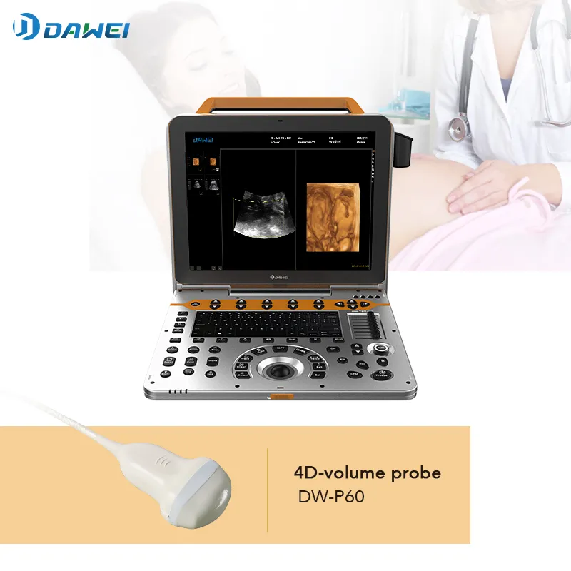Ultrasound Diagnostic Scanner Side View