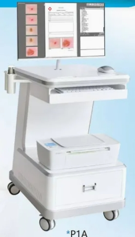 Smart Dermatoscope with Mobile Connectivity and Analysis Tools