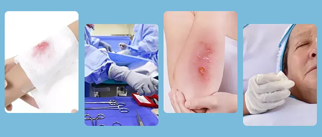 Indications Overview