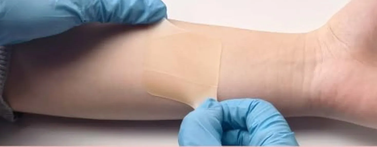 Removal instructions