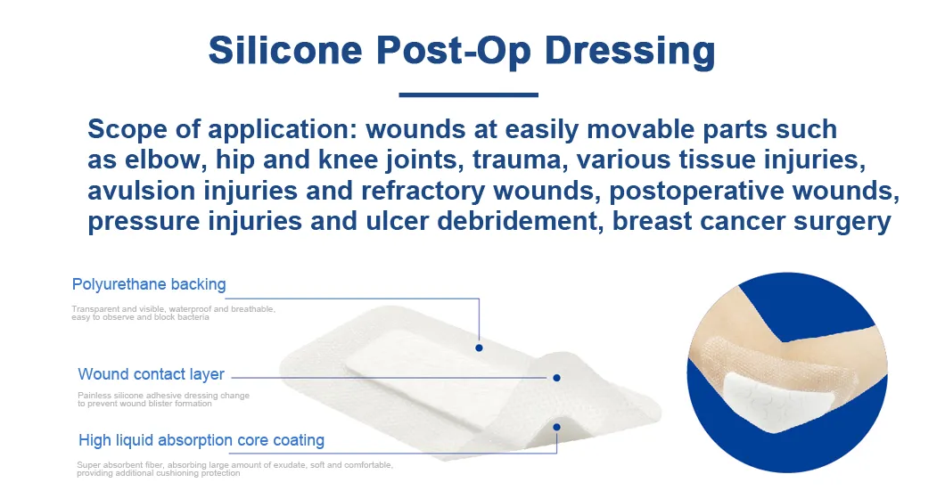 Silicone Dressing Layer