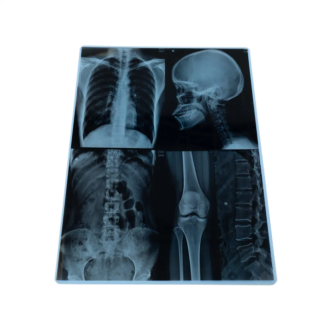 X-ray Film Solution 1