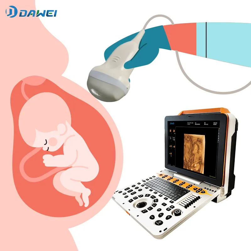 Ultrasound Diagnostic Scanner Front View