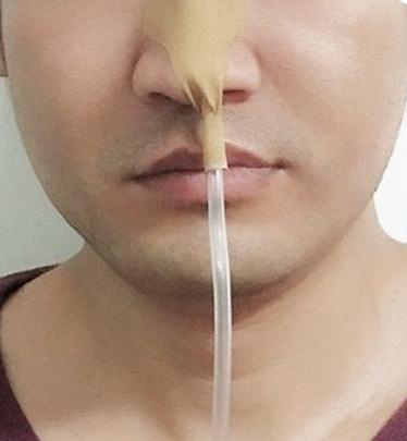 Hot Sale Nasal Oxygen Delivery Tube Fixed Dressing Skin Color