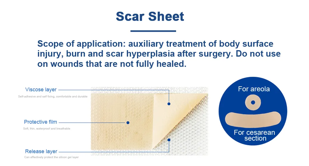 Silicone Scar Sheet Details