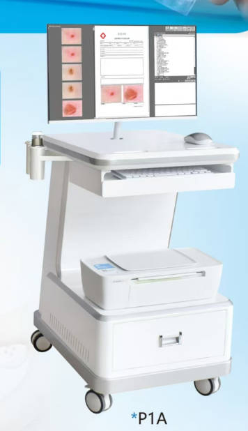 Smart Dermatoscope with Mobile Connectivity and Analysis Tools