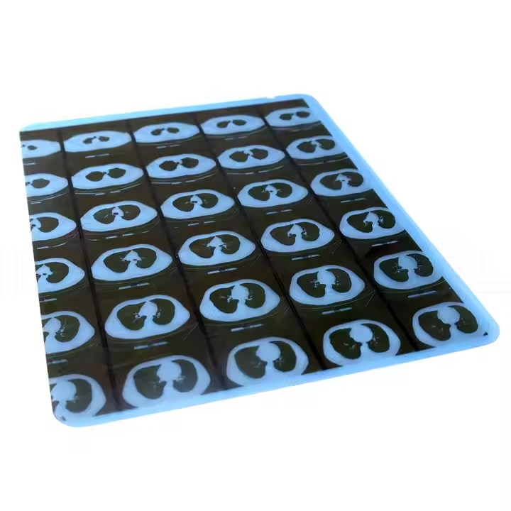 Cutting-Edge X-ray Film Printing Solutions for Medical Use