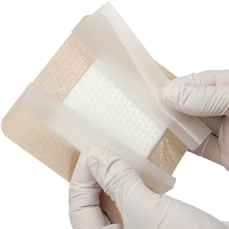 Silicone Foam Dressing Application