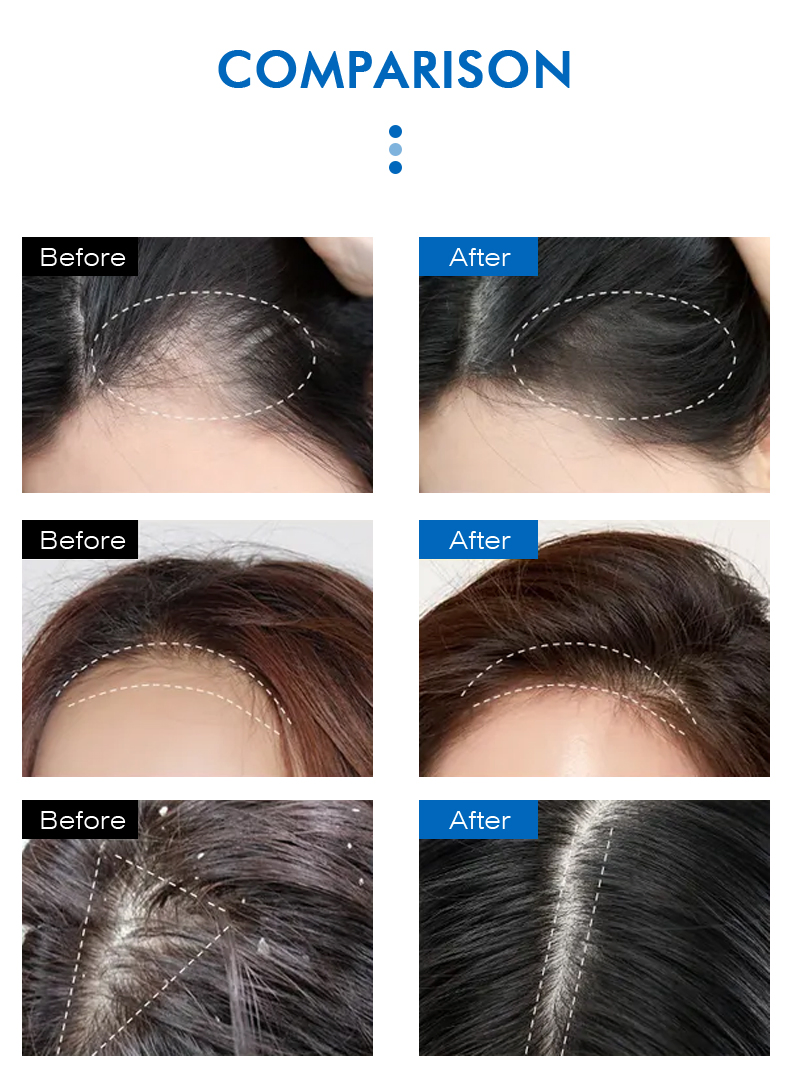 Customize Logo Ekber Natural Hair Luxury Blue Copper Peptide Shampoo Kit Hair Care Growth Color Protection Shampoo