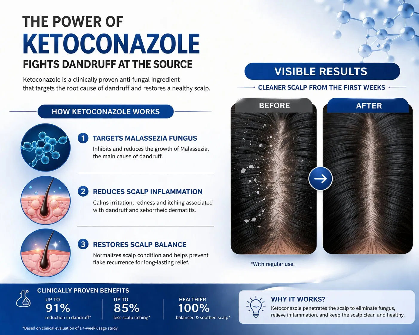 Advanced Ketoconazole Hair Shampoo for Dandruff Control and Scalp Health Best Anti Dandruff