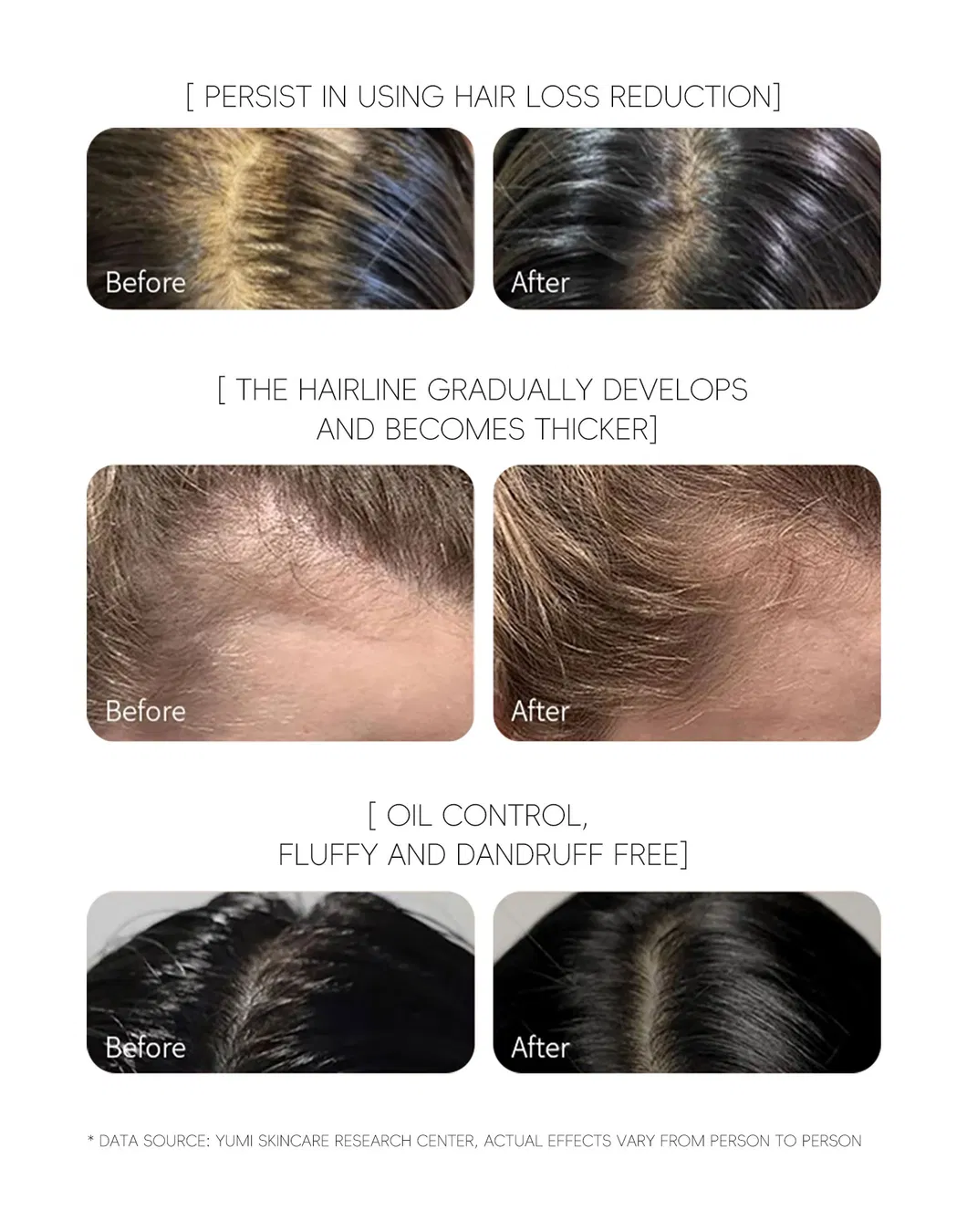 Ginger Anti Hair Loss Hair Growth Shampoo