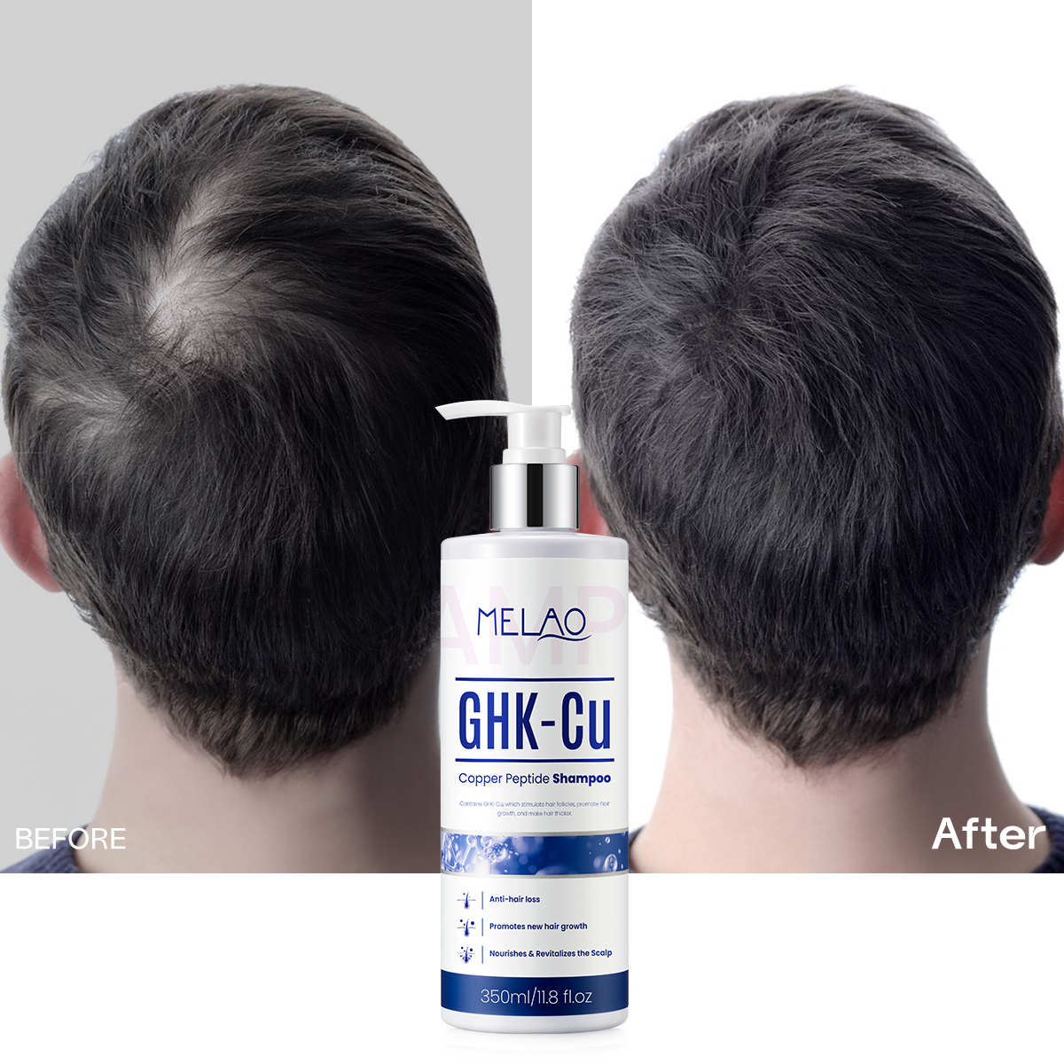 DHT Blocker Shampoo Private Label GHK-Cu Copper Peptide Biotin Keratin Curly Hair Anti-Hair Loss Hair Growth Moisturizing Halal