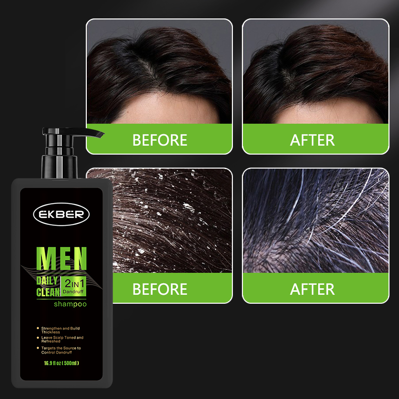 Customize Logo Sulfate Free Scalp Balance Care Hair-Loss Prevention Natural Man's 2in1 Anti-Dandruff Shampoo