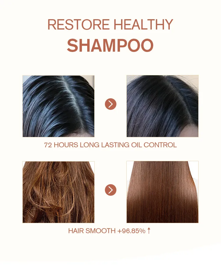 Oil Control Volumizing Shampoo Scalp Health Benefits
