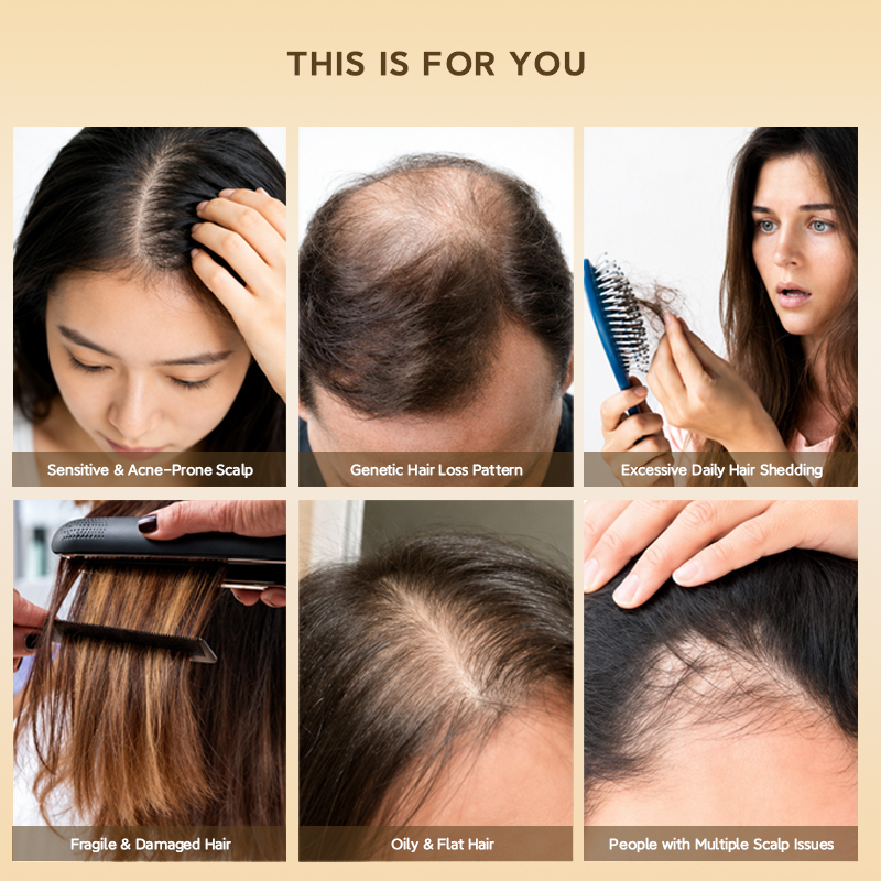 Newest Anti Hair Loss Shampoo Root Strengthening Extend Hair Growth Cycle DHT Blocker Caffeine Ginseng Anti Hair Loss Shampoo