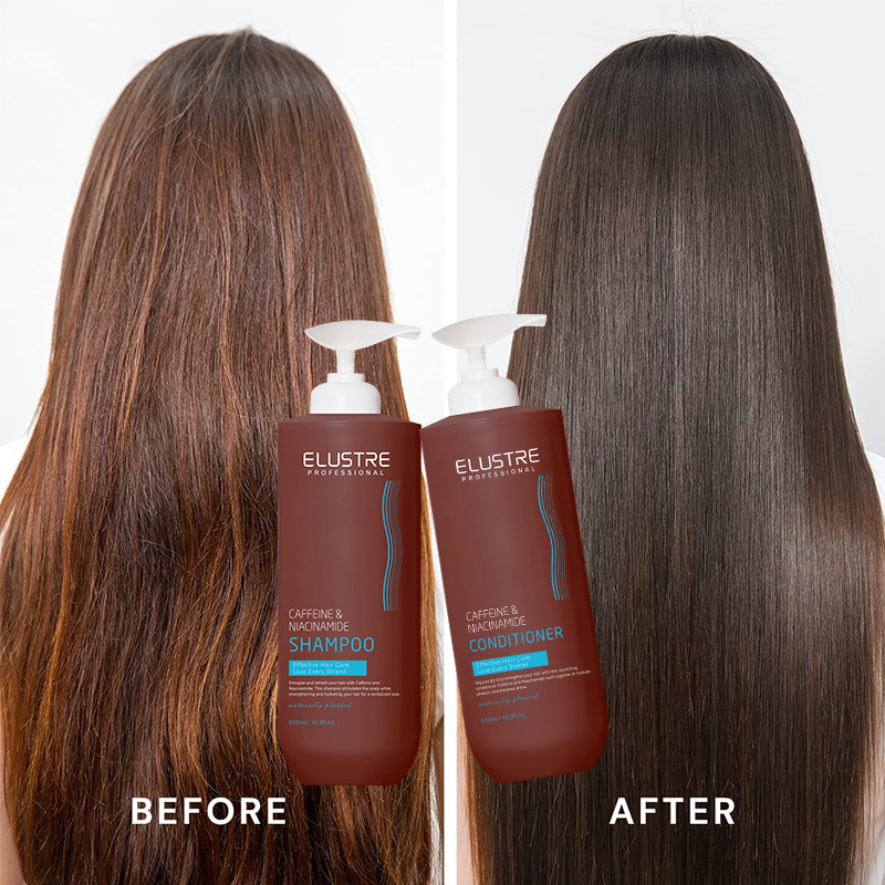 Coffee &amp; Niacinamide Anti-Dandruff Hair Shampoo | Oil Control &amp; Scalp Stimulating Cleanser | Fluffy Vegan OEM Formula