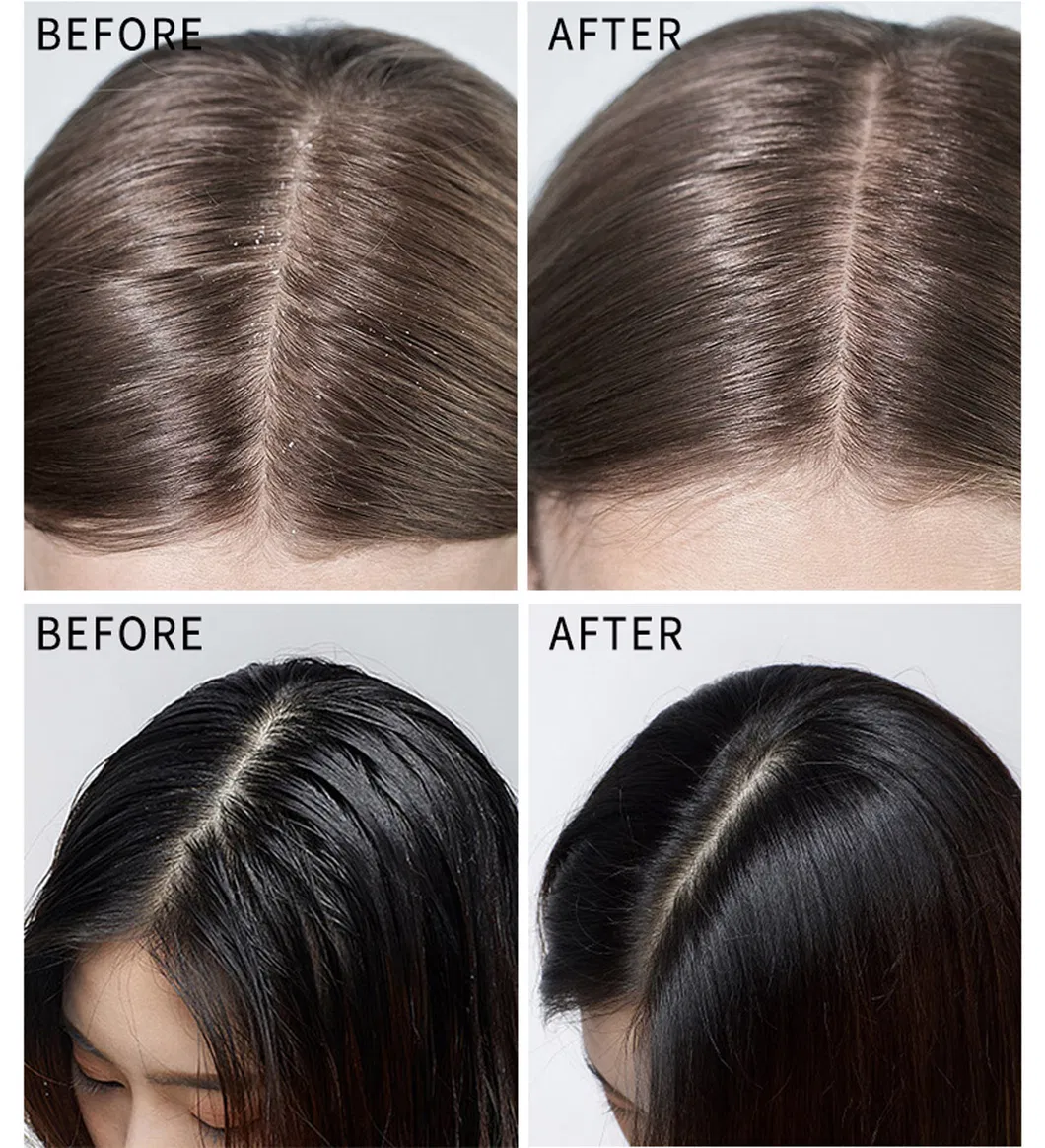 How to Use Deep Cleansing Shampoo