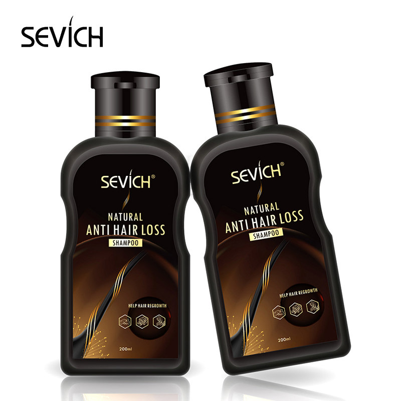Best Ginger Hair Loss Shampoos for Men and Women
