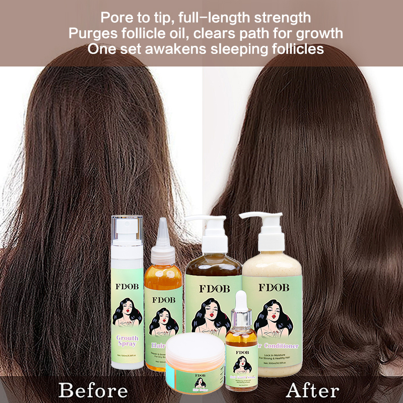Natural Herbal Chebe Hair Care Set Anti-Dandruff Refreshing Shampoo Prevents Thinning Anti-Hair Loss Promotes Hair Growth for