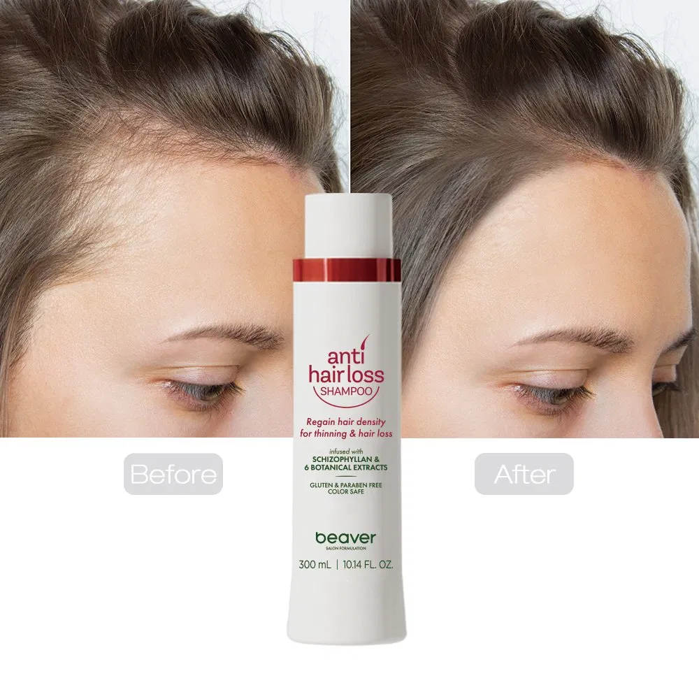 Beaver Natural Herbal Hair Care Growth Biotin Ginseng Anti Hair Loss Shampoo