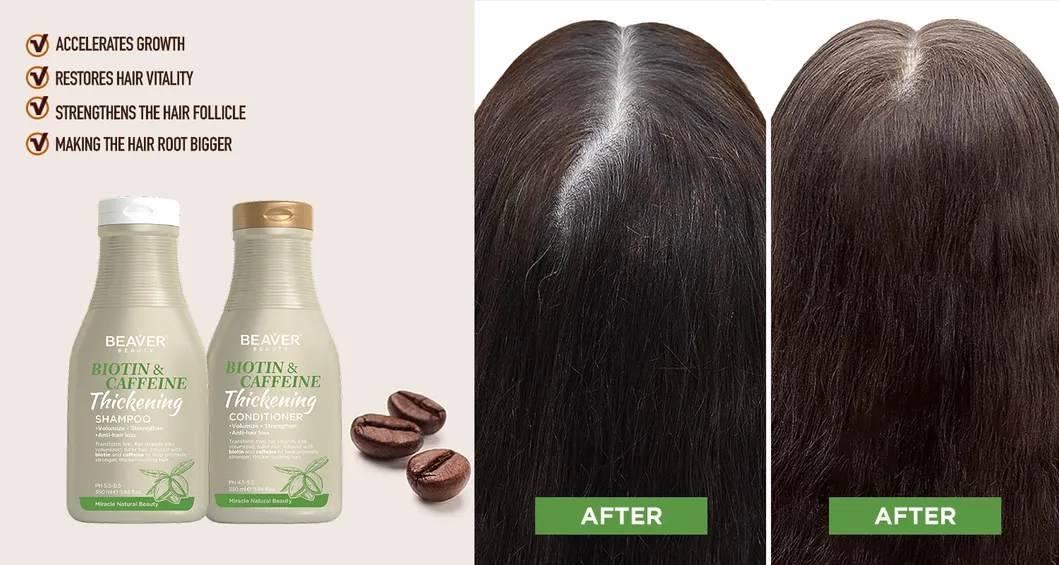 Biotin Hair Care Product Sulfate Free Hair Growth Shampoo Conditioner