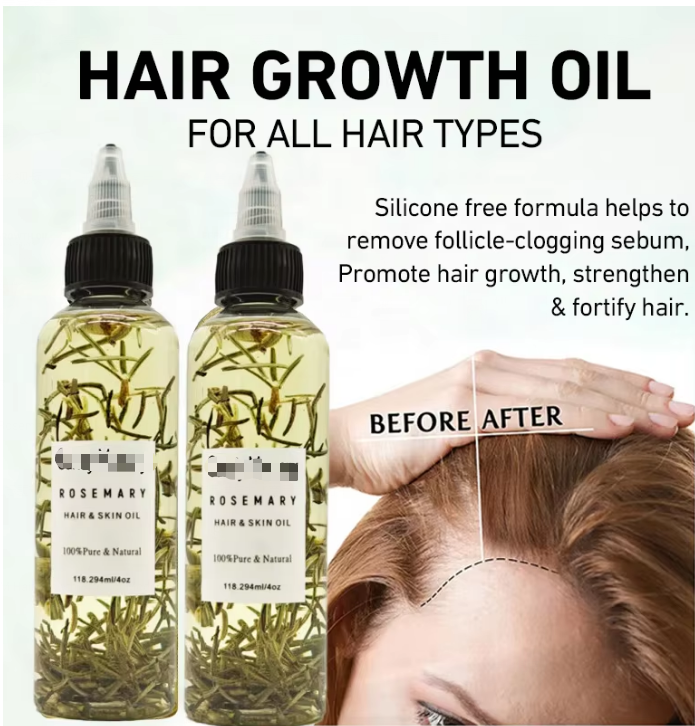 Rosemary Hair Growth Oil &amp; Shampoo Nourishing Anti-Frizz Scalp Care Private Label Wholesale Organic 100ml/200ml