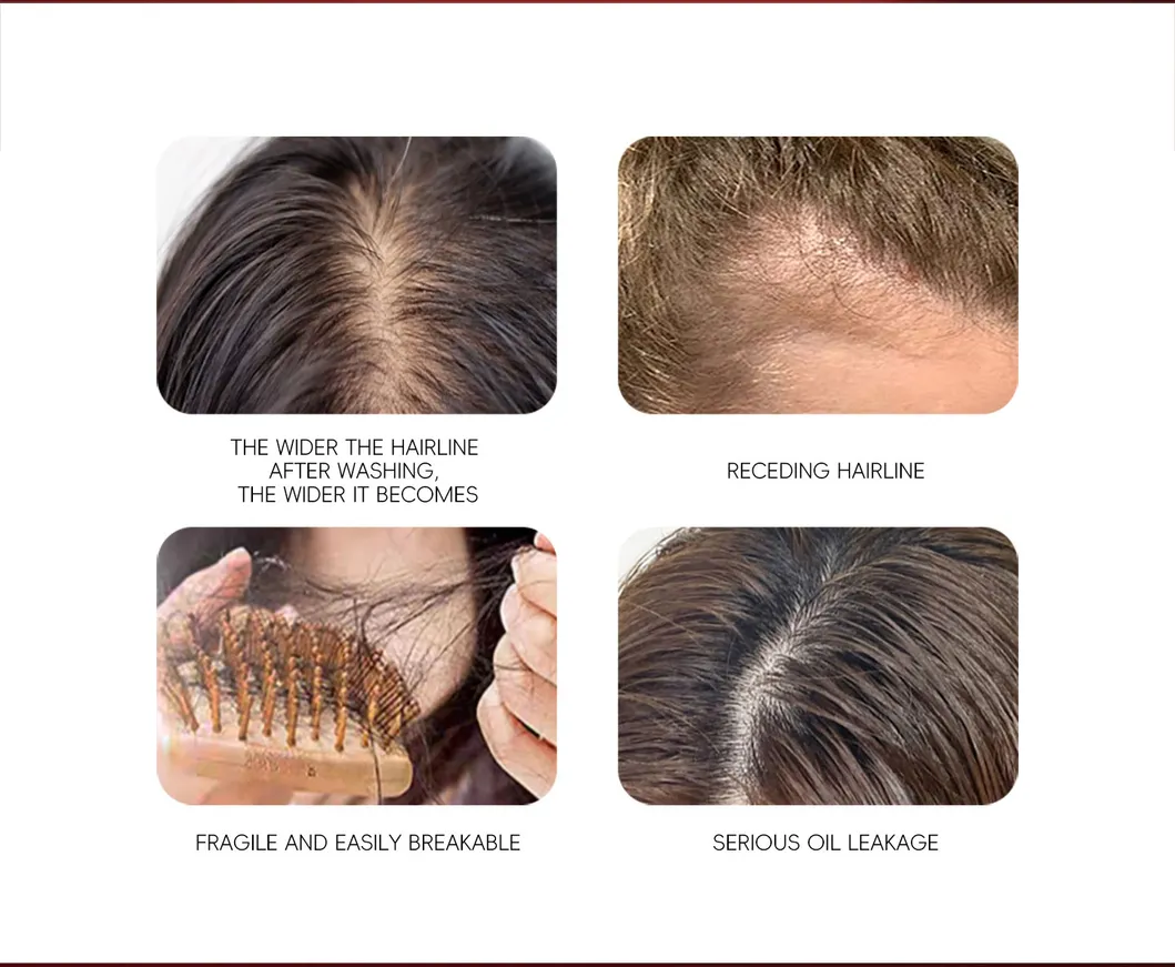 Ginger Anti Hair Loss Hair Growth Shampoo
