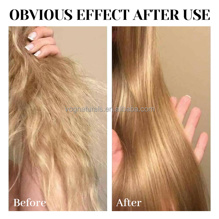 Scalp Treatment