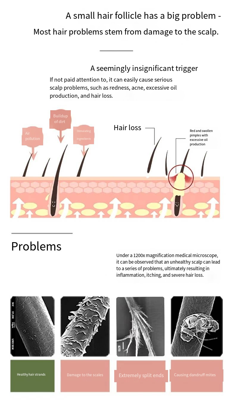 DNA Sodium Oil Control Anti-Hair Loss Anti-Dandruff Shampoo User Tested Reduce Hair Fall 1-3 Weeks Scalp Care Men Women Hair