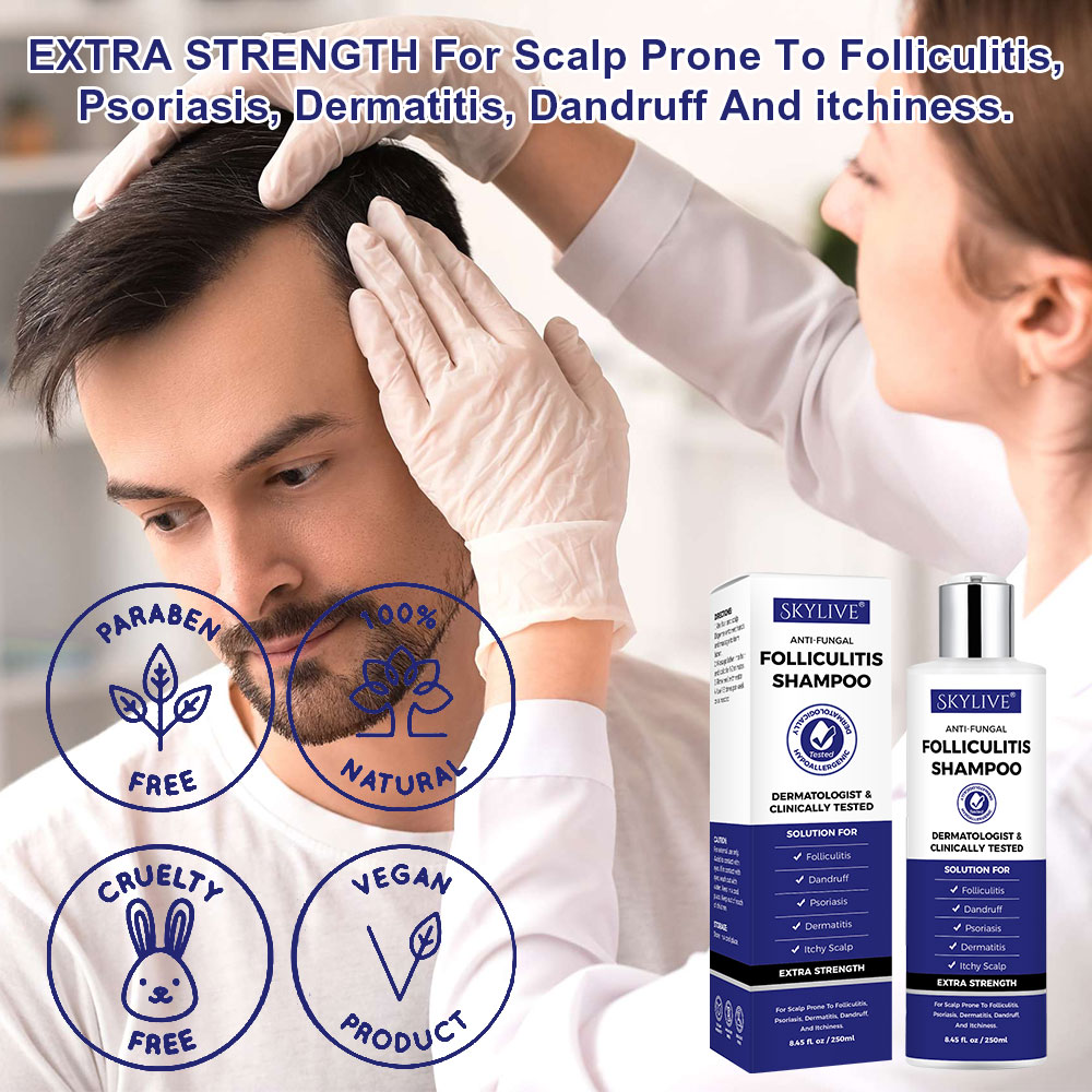 New Arrivals Hair Care Organic Deep Cleansing Shampoo for Revitalizes Scalp Psoriasis Anti-Fungal Shampoo for Folliculitis