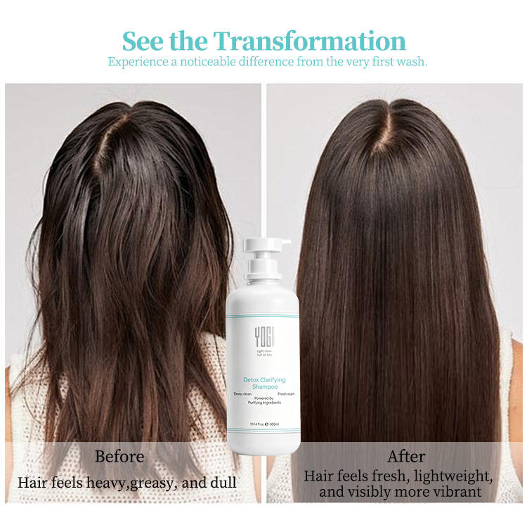 Custom Logo Herbal Detox Moisturizing &amp; Smoothing Scalp Care Nourishing Cream Shampoo for Oily Hair