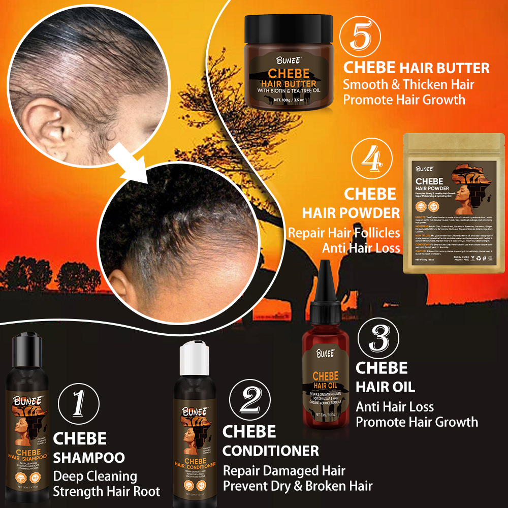 Fast Effects Hair Growth Rosemary Oil Shampoo And Conditioner Chebe Powder Produit Hair Restoration Hair Loss Treatment