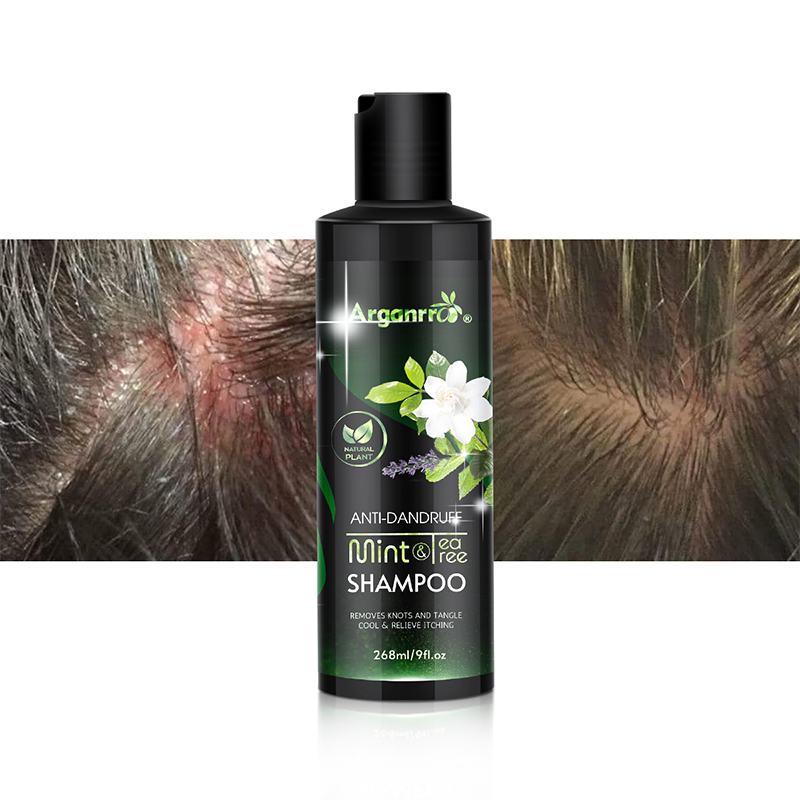 OEM Private Label Scalp Itching and Scalp Treatment Women Tea Tree Mint Perpermint Shampoo