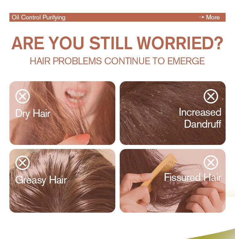 Oil Control Volumizing Shampoo Formulation Details