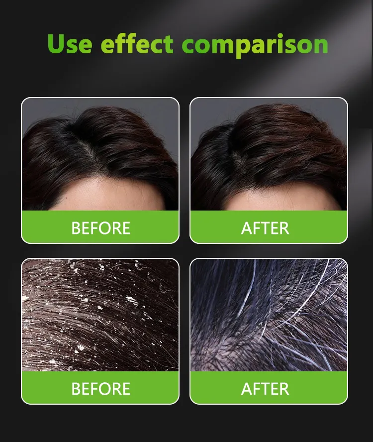 Man's 2in1 Anti-Dandruff Shampoo Detail 5